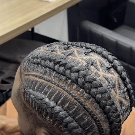 Scalp Braids